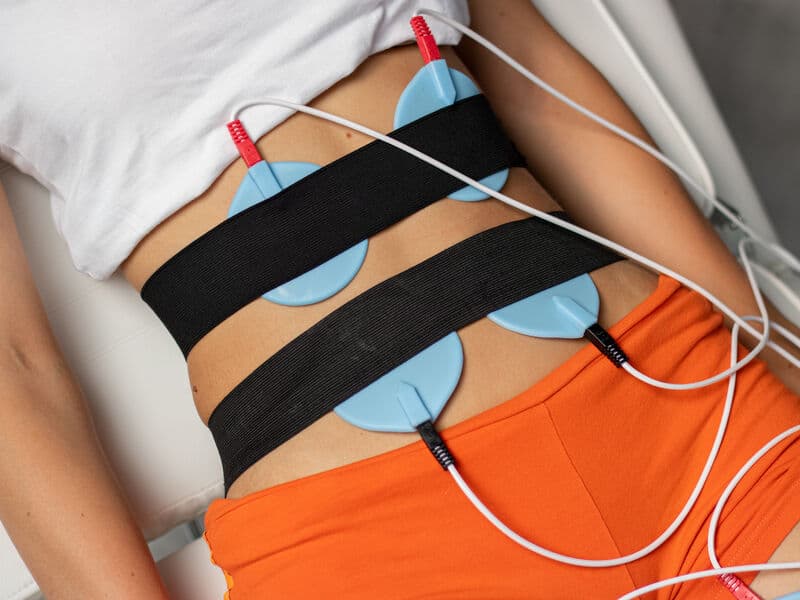 Elektrostymulacja IR – przygotowanie