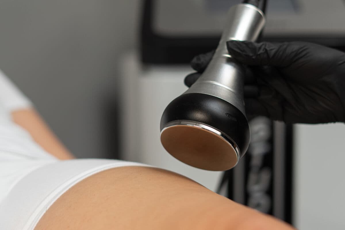 Liposukcja kawitacyjna – efekty